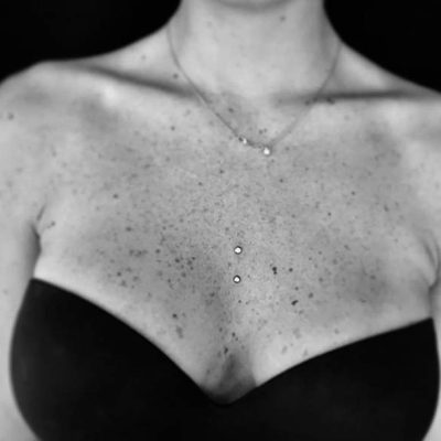 microdermal